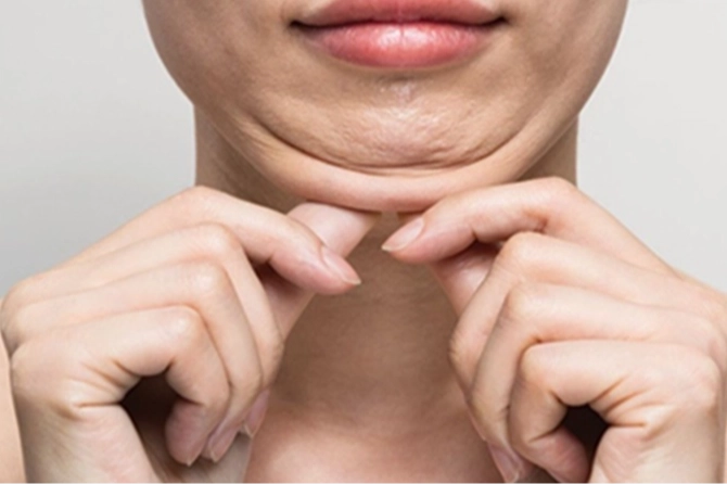 Keşanlı Üç Dermatolog Tiflis'te Buluştu
